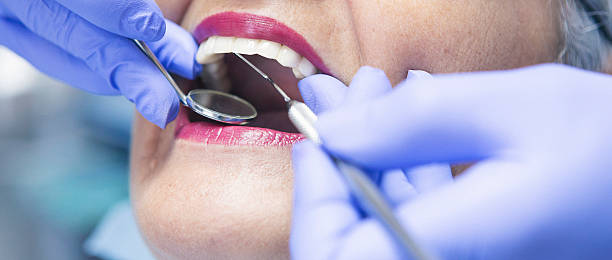 Best Emergency Dentist for Lost Fillings or Crowns in Fall River, WI